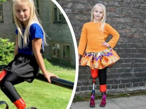Daisy, 9 anni e ha entrambe le gambe amputate, ma sfilerà alla Fashion Week di New York