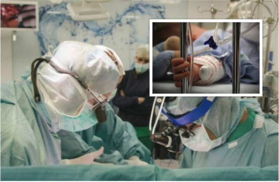 Miracolo in Campania, bimba di 22 mesi salvata dai medici. Era nata con un tumore al cervello
