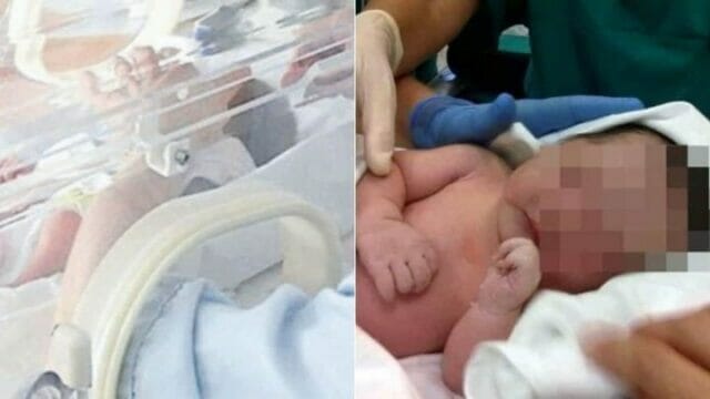Dramma in Campania, donna partorisce da sola in ospedale: il bimbo nasce morto
