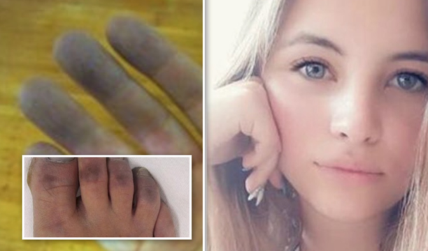 Melissa, mani e piedi neri dopo il malore: svelata la probabile causa della morte