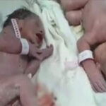 Terremoto Albania, la forza della vita: gemelli nascono 20 minuti dopo il terremoto