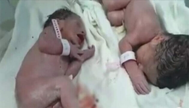 Terremoto Albania, la forza della vita: gemelli nascono 20 minuti dopo il terremoto