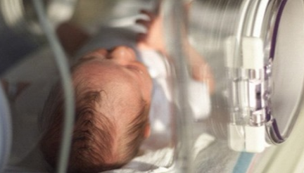 Asportato tumore a un neonato ancora collegato al cordone ombelicale della mamma