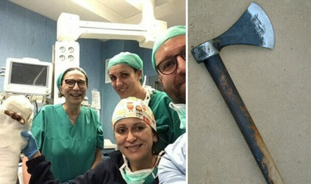Intervento incredibile: si taglia la mano con un’ascia, ma i medici riescono a riattacargliela