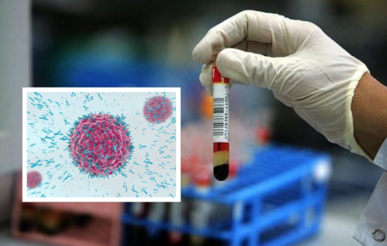 Tumori, rivoluzione nella diagnosi: test del sangue rileva segni prima che si manifestino