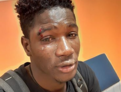 “Via da qui negro”. Vergogna in Italia: ragazzo di 20 anni di colore preso a calci e pugni