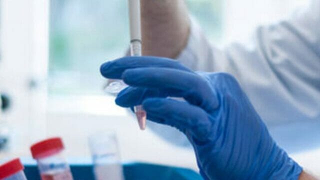 “Solo il 5% sviluppa anticorpi”. L’immunità di gregge contro il Coronavirus è quasi impossibile