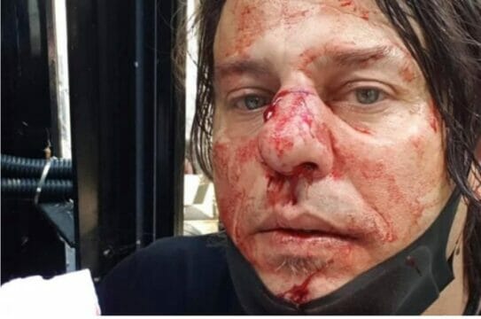 Londra, scontri tra estremisti di destra e polizia: ferito fotoreporter italiano. Solidarietà da Odg, Fnsi e Sugc