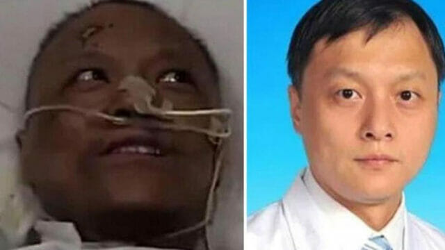 Covid, in Cina è morto il medico che si risvegliò con la pelle nera