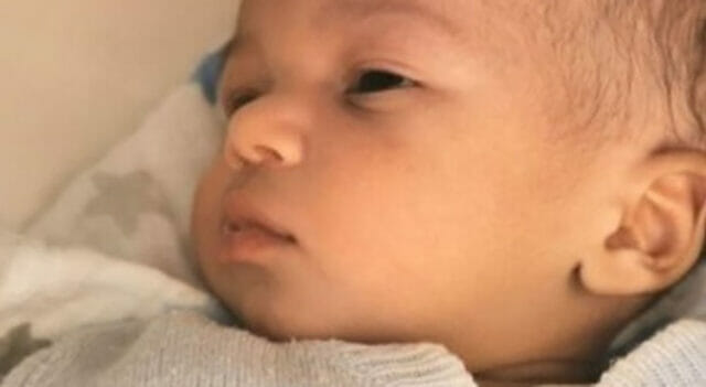 Meningite, neonato muore dopo interventi al cervello