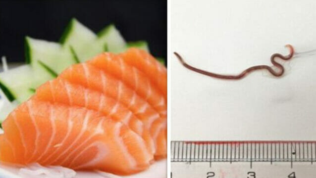 Mangia pesce crudo, le cresce un verme nero attorno alla tonsilla