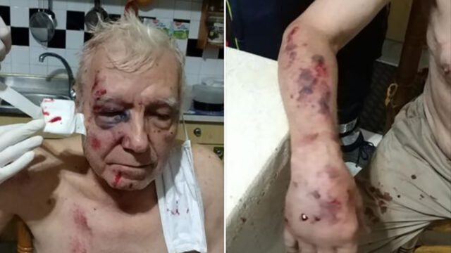 Misteriosa aggressione ad un anziano: è ricoverato sotto choc