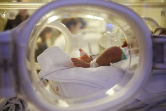 Neonato di 28 giorni operato all’ospedale Cardarelli di Napoli per una malformazione che danneggiava polmoni e cuore:salvato dall’equipe medica