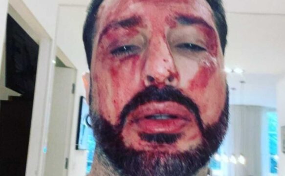 Fabrizio Corona deve tornare in carcere. Lui disperato si taglia i polsi e insulta i giudici