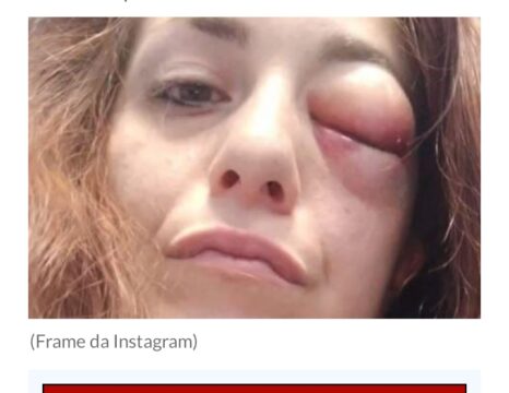 Giuliana Danzè, la cantante di “The Voice”, pestata brutalmente dal compagno