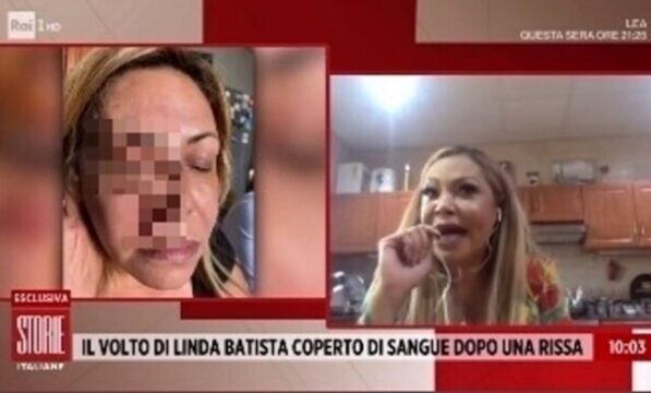 Picchiata a sangue Linda Batista, l’ex di Rossano Rubicondi aveva difeso un gay