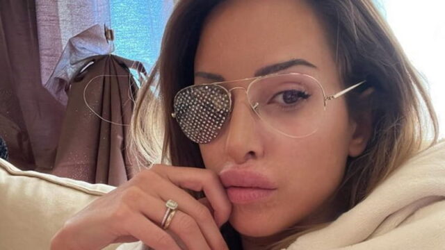 Gessica Notaro, la vittima di acido che tornerà a vedere: “Farò un’operazione alla cornea, sono miracolata”