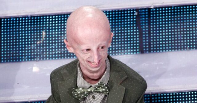 È morto Sammy Basso, colui che ha fatto conoscere la progeria: aveva 28 anni