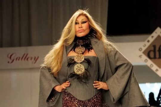 Addio a Jocelyn Wildenstein, la donna gatto famosa per la chirurgia plastica estrema