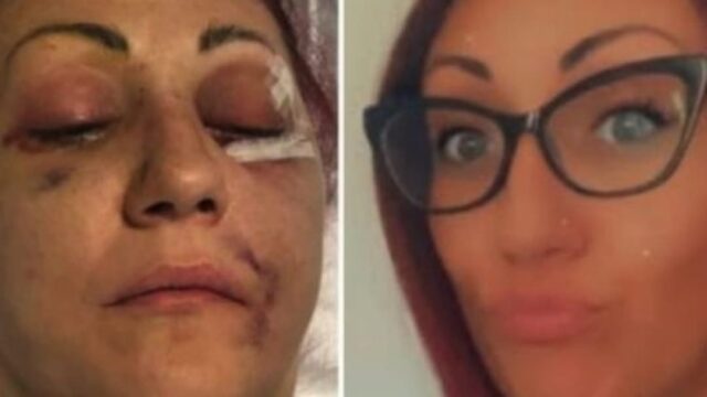 La massacra di botte e la sfigura, ma non va in carcere: per il giudice lui “va compreso”