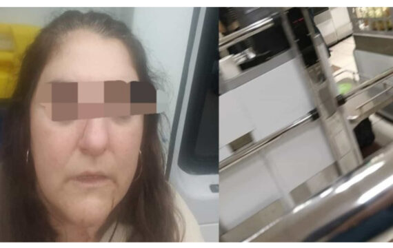 Firenze, donna aggredita a pugni sul viso in strada: “Non parlare napoletano”