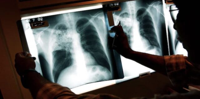 San Giovanni Bosco, i referti “su ordinazione” del clan Contini: così l’ospedale diventava centrale delle truffe