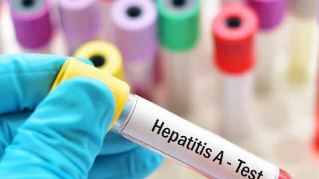 Boom di casi di Epatite A in Campania: la regione intensifica i controlli alimentari