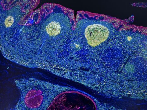 Tumori: la “mappa GPS” delle cellule rivoluziona l’immunoterapia. Nasce in Campania un nuovo polo d’eccellenza dell’IRCCS Pascale