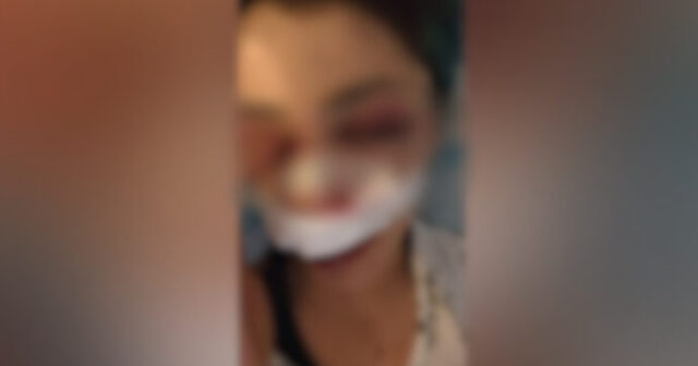 Studentessa picchiata a Bari, identificati due adulti per l’aggressione